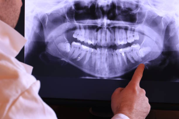 Best Emergency Dentist for Knocked-Out Tooth in Beaver, UT