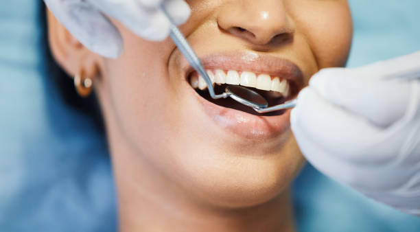 Best Broken or Cracked Tooth Emergency Dentist in Beaver, UT